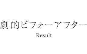 劇的ビフォーアフター - Result