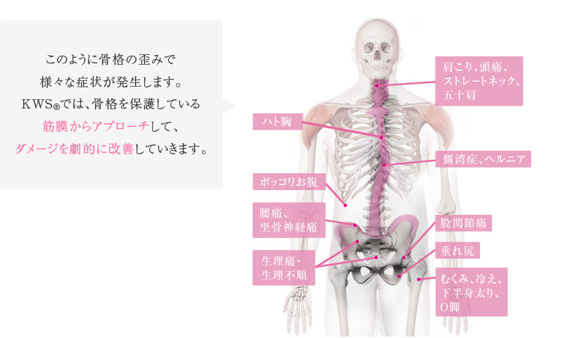 このように骨格の歪みで様々な症状が発生します。KWS®では、骨格を保護している筋膜からアプローチして、ダメージを劇的に改善していきます。