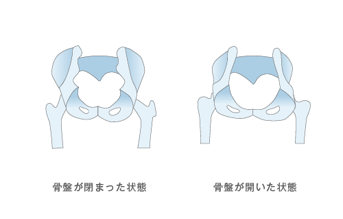 骨盤の開き比較